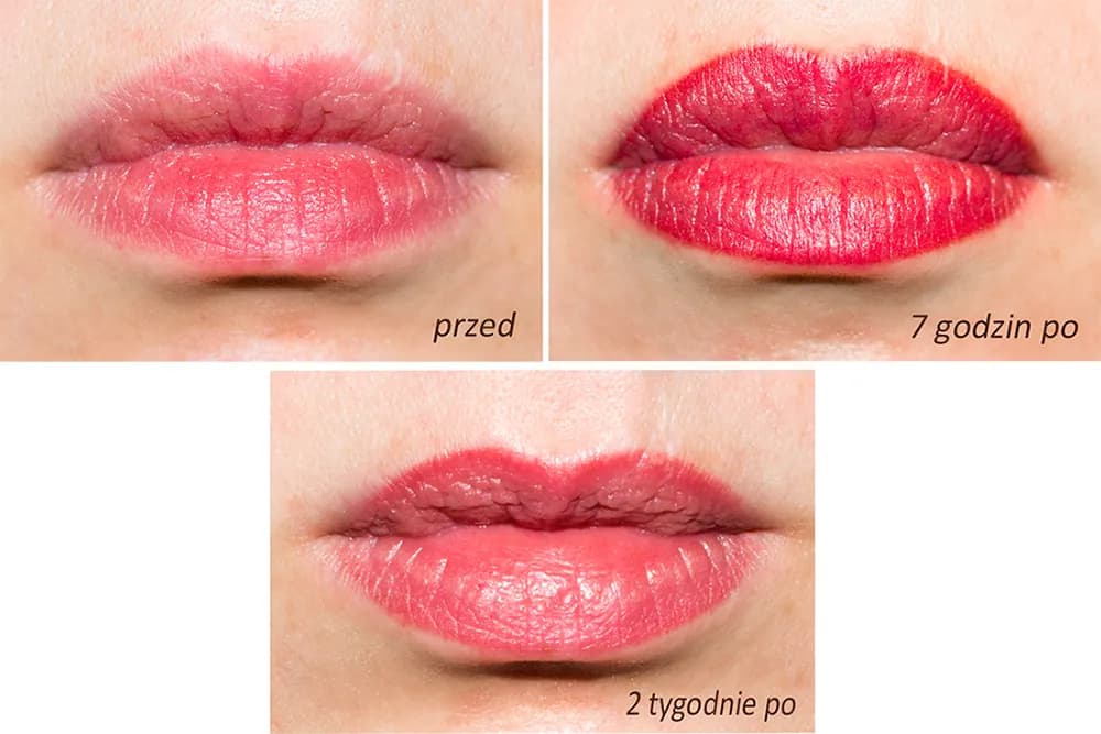 Czy makijaż permanentny ust powiększa usta? Poznaj prawdę o efektach zabiegu