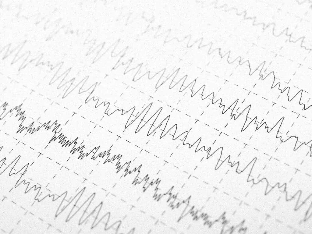 Nieprawidłowy zapis EEG u dziecka - co oznacza i jak działać?